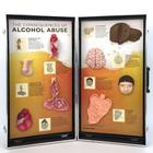 Az alkoholfogyasztás következményei – 3 dimenziós bemutató tábla, 1005582 [W43053], Kábítószerekkel és alkoholfogyasztással kapcsolatos oktatás