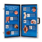 Consequences of High Blood Pressure 3D Display, 1018277 [W43081], Heart Health and Fitness Education