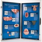 The Consequences of STDs -3D Display, 1018280 [W43089], Sex Education