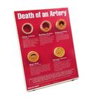 Death of An Artery Easel Display, 1018290 [W43121], Heart Health and Fitness Education