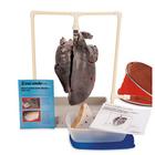 BioQuest Simulated Smoker's Lungs Demonstration Kit, 1009189 [W44131], Tobacco Education