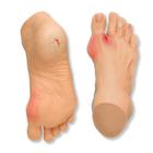 Common Foot Problems Model, 3004419 [W44729], Diabetic Teaching Tools