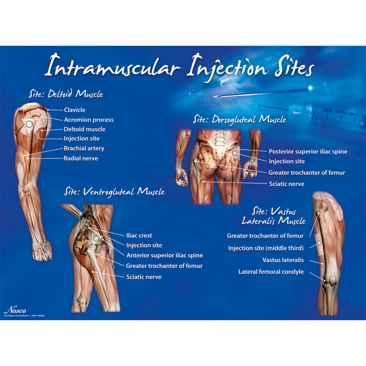 Intravenous Injection Sites