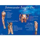Плакат с обозначением мест внутримышечных инъекций, 1018427 [W44783], Плакаты по мышечной системе