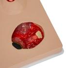 "Pat" Pressure Ulcer Staging Model&trade;, 3001171 [W46517], Decubitus Care (Small)