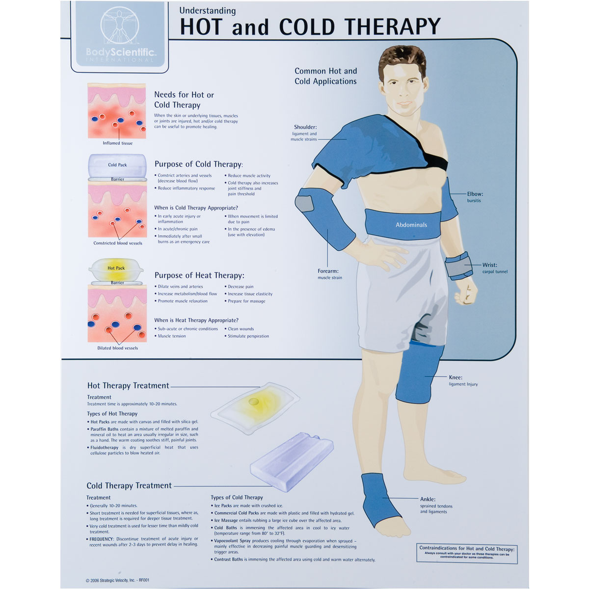 Hot and Cold Therapy Chart - Laminated - W59505 - Dgi - 7801-08