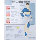 Hot and Cold Therapy Chart - Laminated, W59505, Fitness