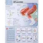 Strengthening the Hip and Knee Chart - Laminated, W59508, Fitness