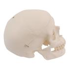Ricambio cranio con foro per A10, A12, A15, A15/2, A15/3 e A15/3S, 1020653 [XA022], Ricambi