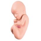 L10/4 için yedek fetus, 1018629 [XL002], Yedek Parça